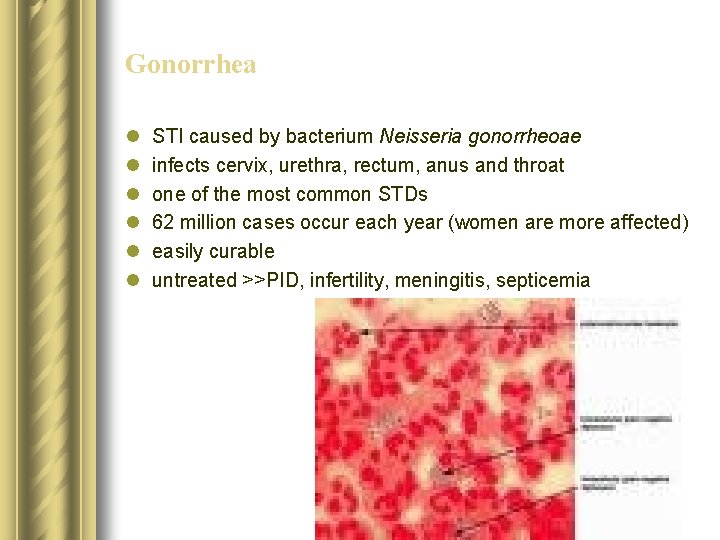 Gonorrhea l l l STI caused by bacterium Neisseria gonorrheoae infects cervix, urethra, rectum, Gonorrhea l l l STI caused by bacterium Neisseria gonorrheoae infects cervix, urethra, rectum,