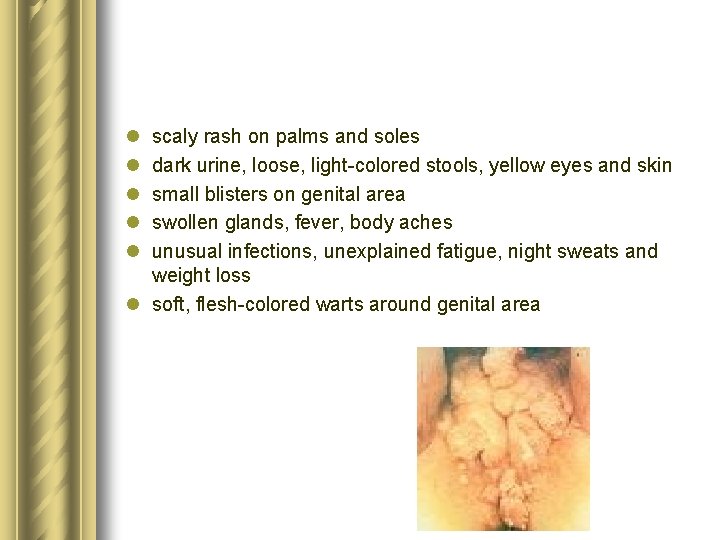 Sexually transmitted diseases chlamydia gonorrhea Mirela Grdovi Mentor