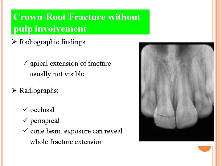 Crown-Root Fracture without pulp involvement Ø Radiographic findings: ü apical extension of fracture usually