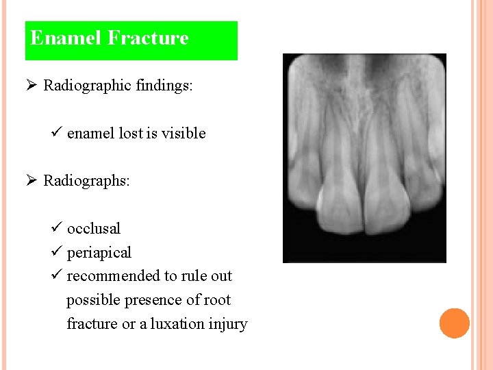 Enamel Fracture Ø Radiographic findings: ü enamel lost is visible Ø Radiographs: ü occlusal