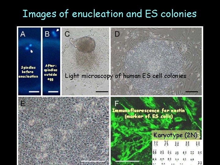 Images of enucleation and ES colonies Spindles before enucleation After: spindles outside egg Light