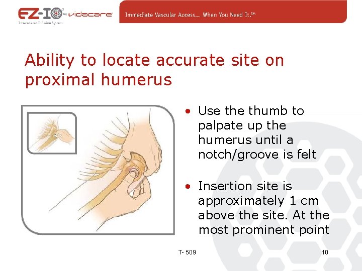 Ability to locate accurate site on proximal humerus • Use thumb to palpate up