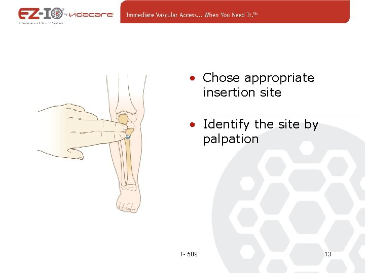  • Chose appropriate insertion site • Identify the site by palpation T- 509