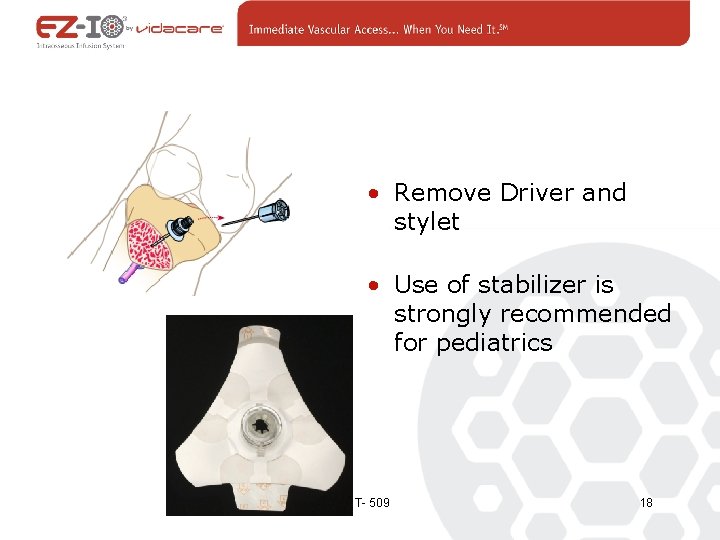  • Remove Driver and stylet • Use of stabilizer is strongly recommended for