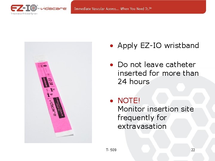  • Apply EZ-IO wristband • Do not leave catheter inserted for more than