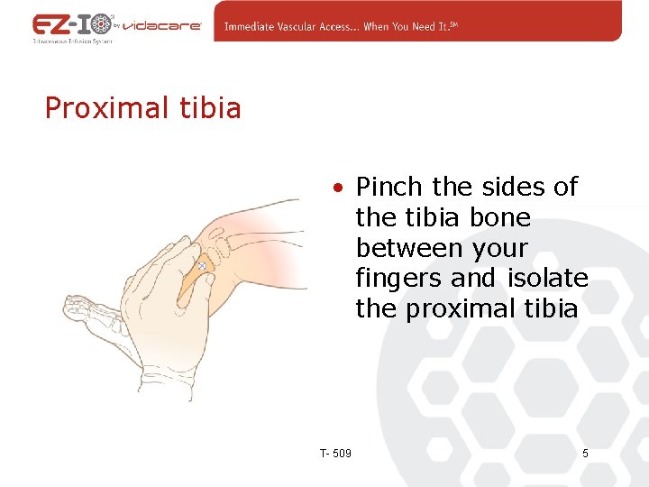 Proximal tibia • Pinch the sides of the tibia bone between your fingers and