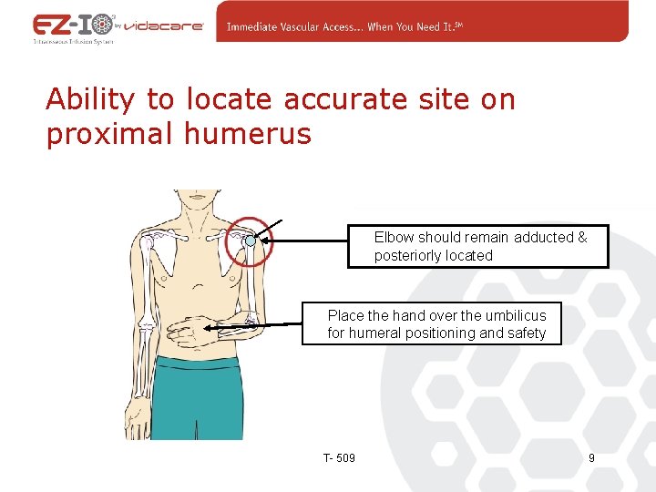 Ability to locate accurate site on proximal humerus Elbow should remain adducted & posteriorly