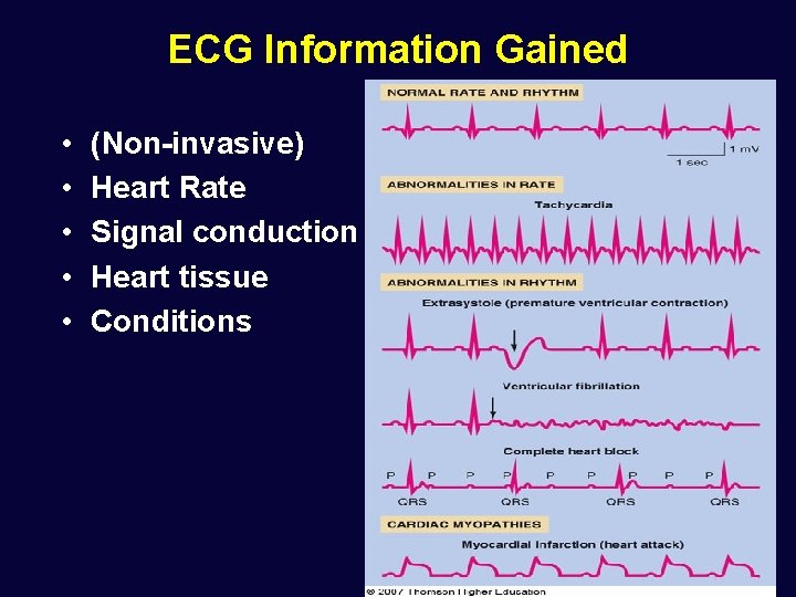 ECG Information Gained • • • (Non-invasive) Heart Rate Signal conduction Heart tissue Conditions