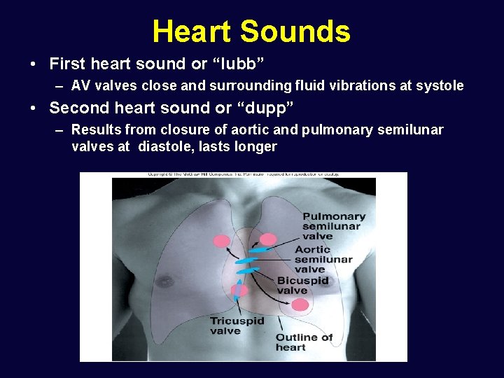 Heart Sounds • First heart sound or “lubb” – AV valves close and surrounding