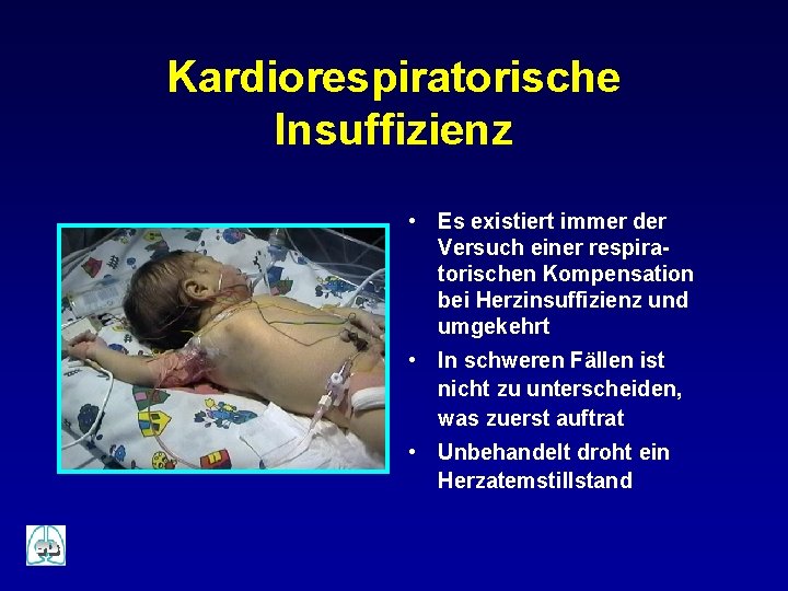 Kardiorespiratorische Insuffizienz • Es existiert immer der Versuch einer respiratorischen Kompensation bei Herzinsuffizienz und