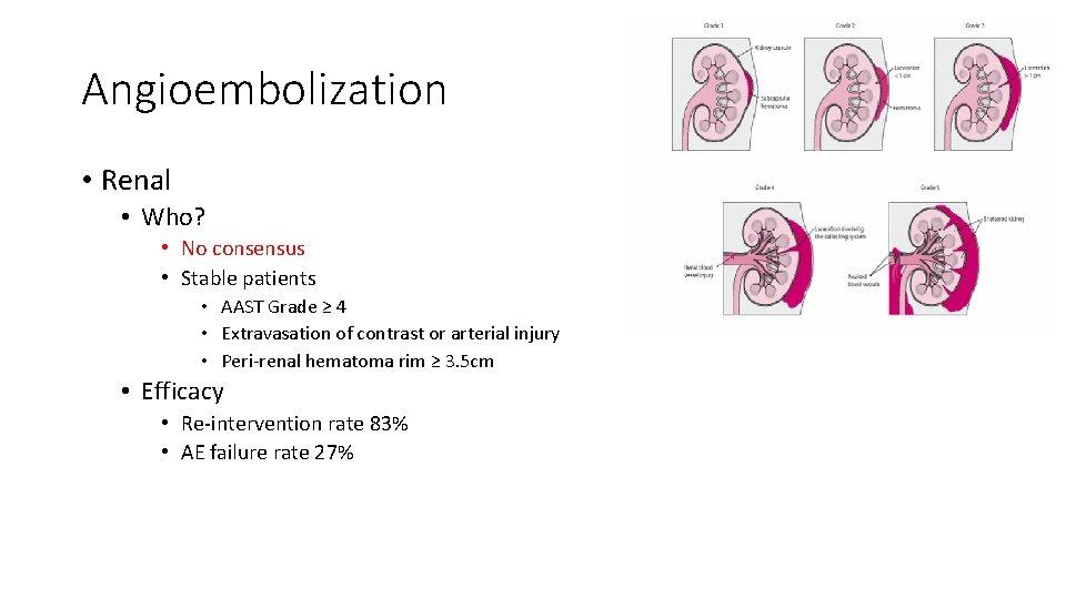 Angioembolization • Renal • Who? • No consensus • Stable patients • AAST Grade