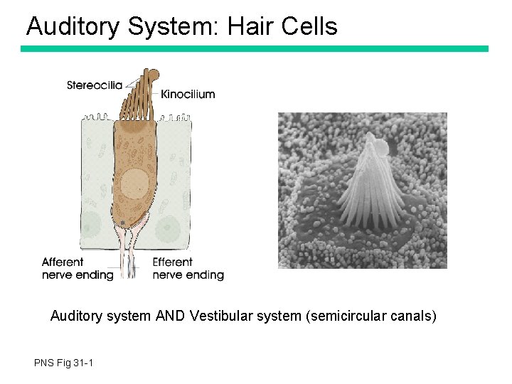 Auditory System: Hair Cells Auditory system AND Vestibular system (semicircular canals) PNS Fig 31