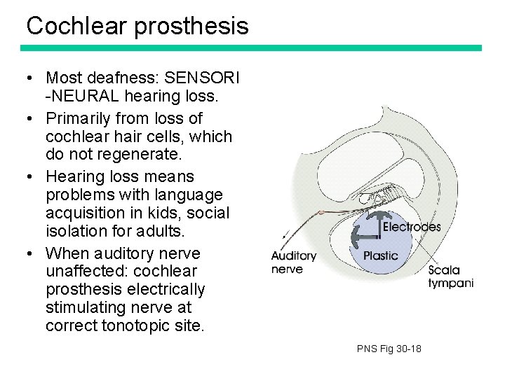 Cochlear prosthesis • Most deafness: SENSORI -NEURAL hearing loss. • Primarily from loss of