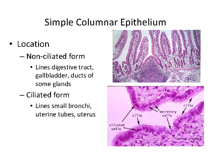 Simple Columnar Epithelium • Location – Non-ciliated form • Lines digestive tract, gallbladder, ducts