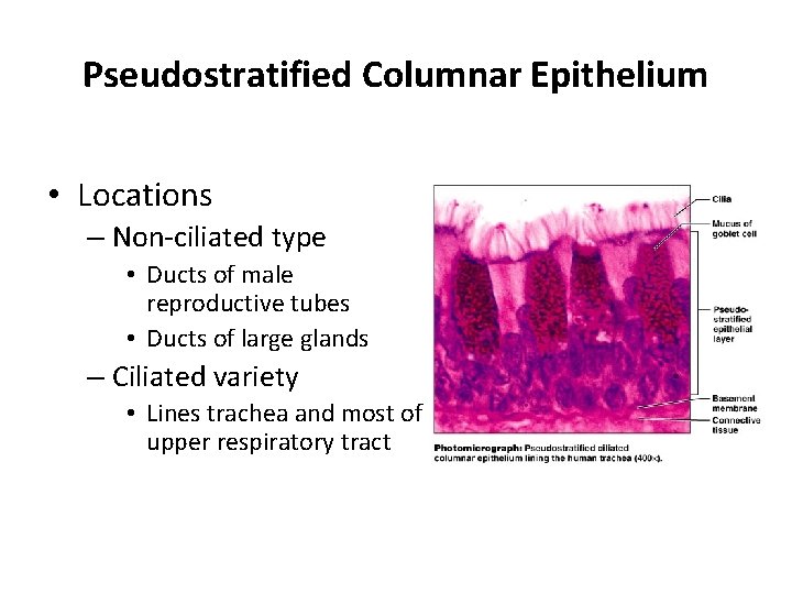 Pseudostratified Columnar Epithelium • Locations – Non-ciliated type • Ducts of male reproductive tubes