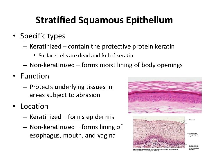 Stratified Squamous Epithelium • Specific types – Keratinized – contain the protective protein keratin