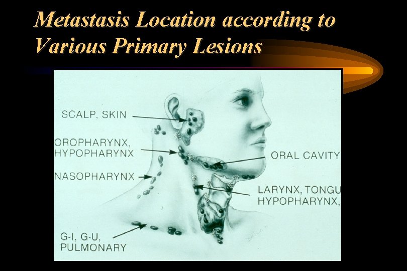 Metastasis Location according to Various Primary Lesions 