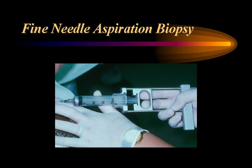 Fine Needle Aspiration Biopsy 