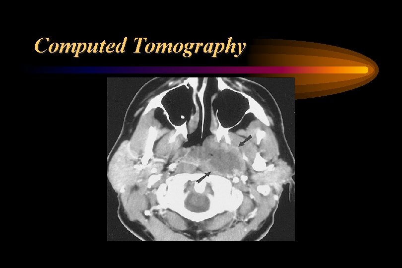 Computed Tomography 