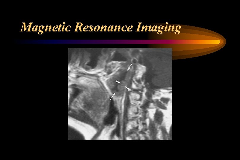 Magnetic Resonance Imaging 