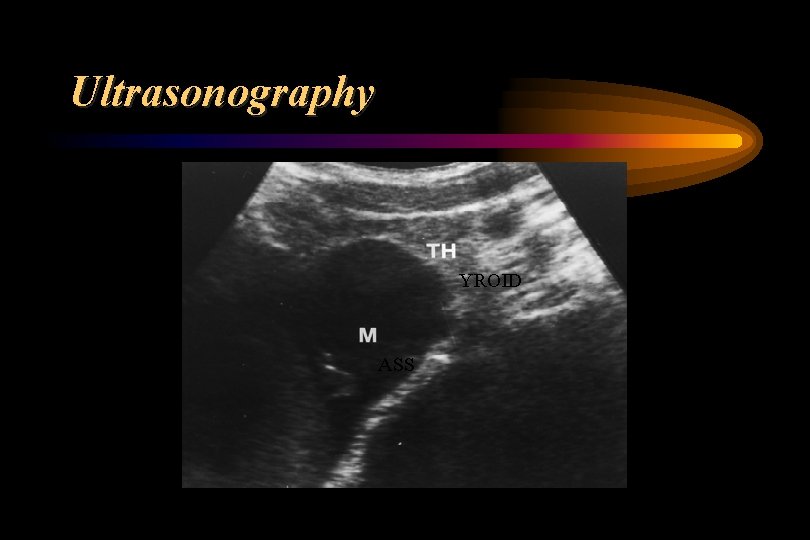 Ultrasonography YROID ASS 