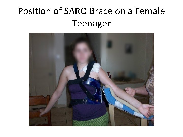 Position of SARO Brace on a Female Teenager 