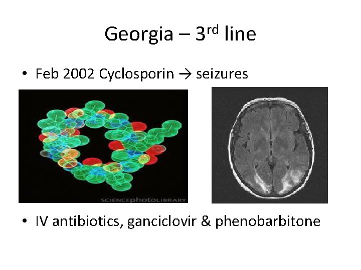 Georgia – 3 rd line • Feb 2002 Cyclosporin → seizures • IV antibiotics,