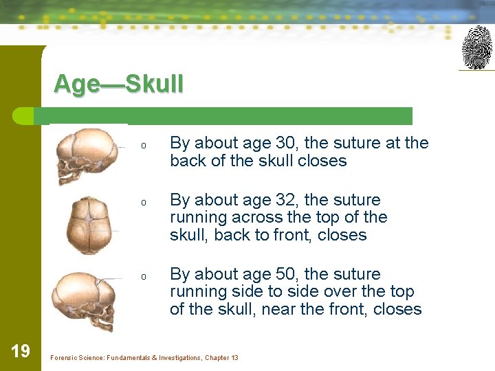 Age—Skull o o o 19 By about age 30, the suture at the back