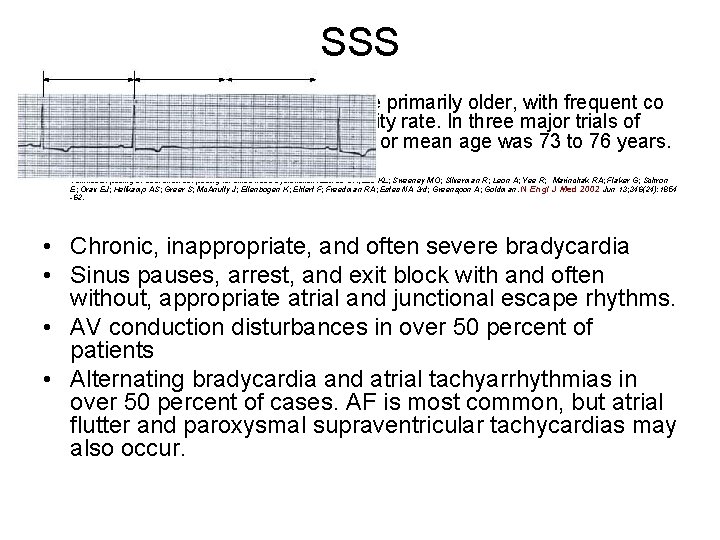 SSS Patients with symptomatic SSS are primarily older, with frequent co morbid diseases and