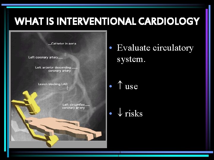 WHAT IS INTERVENTIONAL CARDIOLOGY • Evaluate circulatory system. • use • risks 