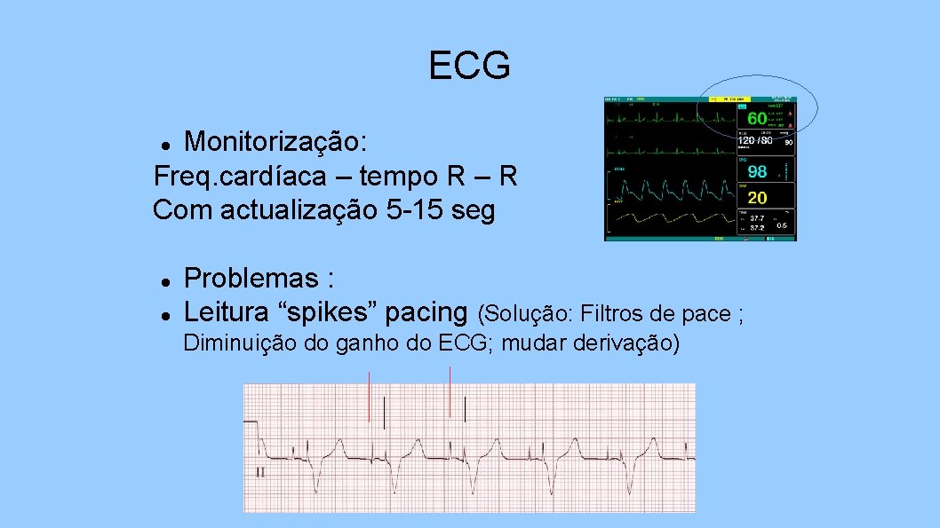 ECG Monitorização: Freq. cardíaca – tempo R – R Com actualização 5 -15 seg