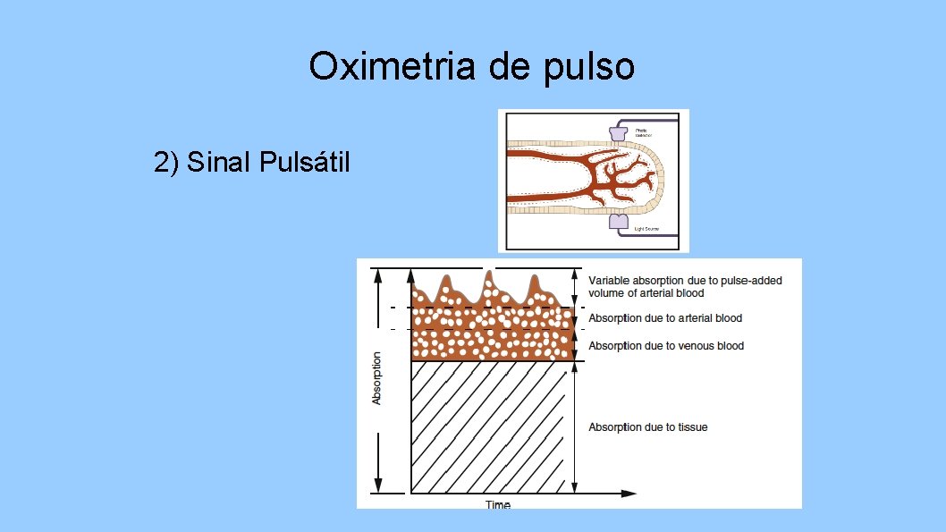 Oximetria de pulso 2) Sinal Pulsátil 