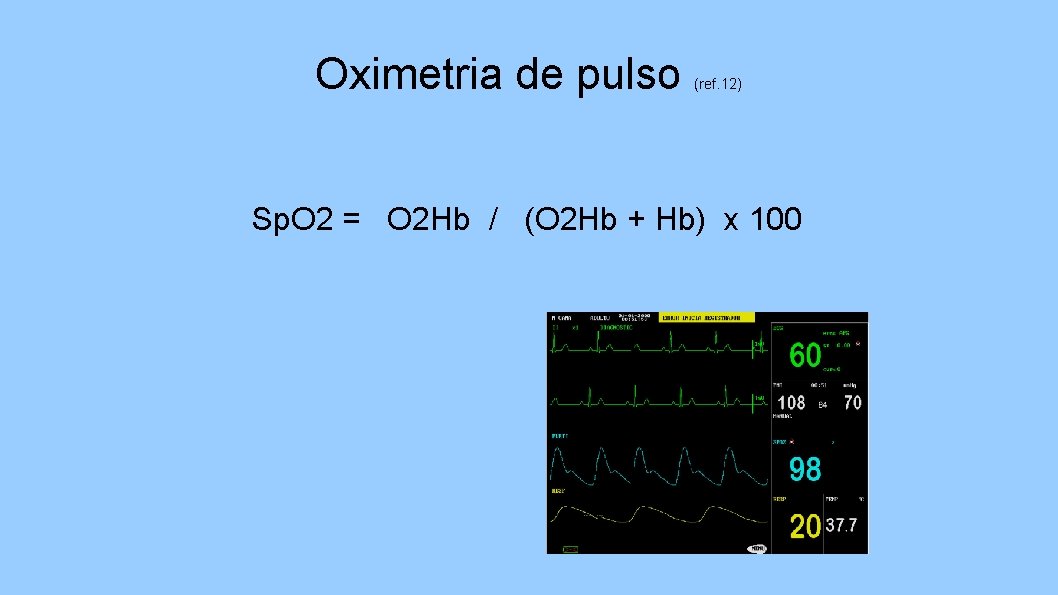 Oximetria de pulso (ref. 12) Sp. O 2 = O 2 Hb / (O