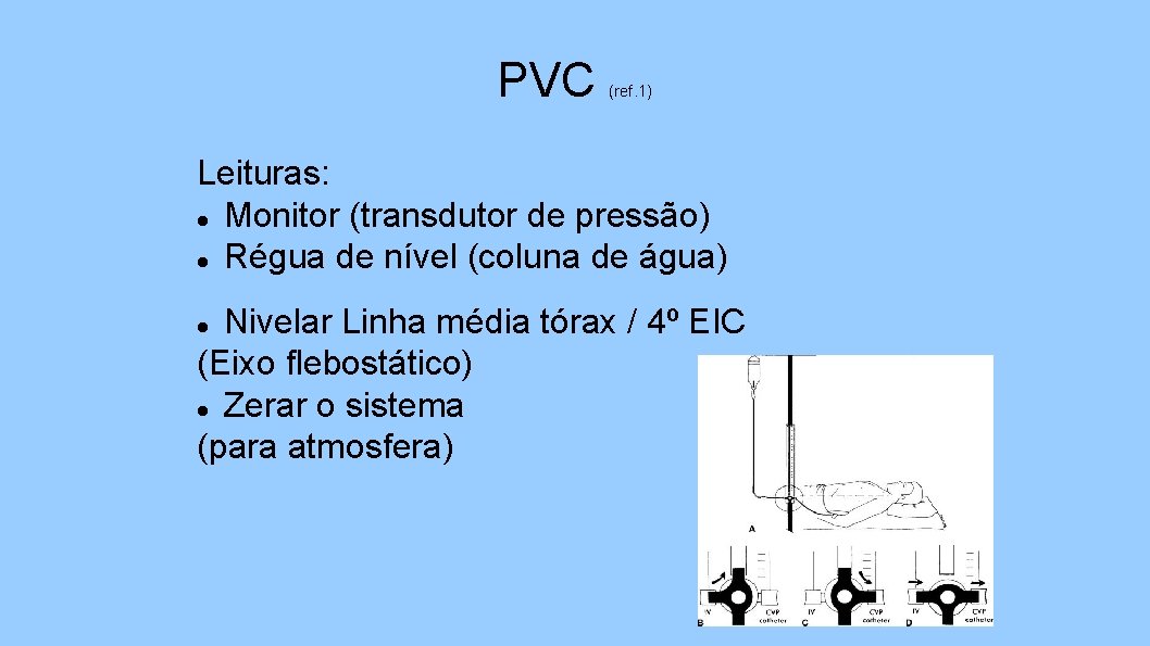 PVC (ref. 1) Leituras: Monitor (transdutor de pressão) Régua de nível (coluna de água)