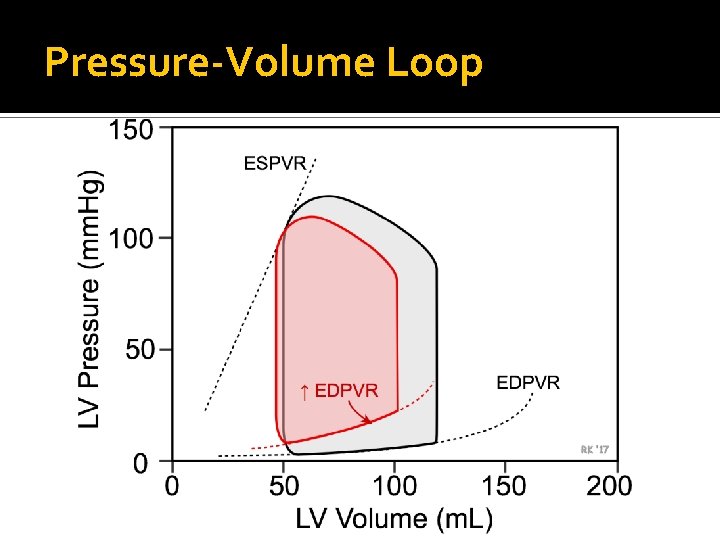 Pressure-Volume Loop 