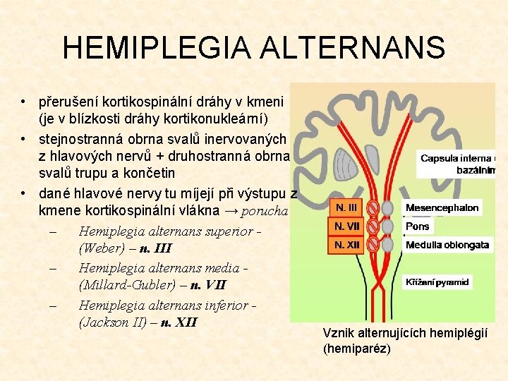 HEMIPLEGIA ALTERNANS • přerušení kortikospinální dráhy v kmeni (je v blízkosti dráhy kortikonukleární) •