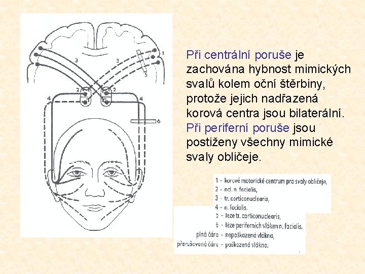 Při centrální poruše je zachována hybnost mimických svalů kolem oční štěrbiny, protože jejich nadřazená