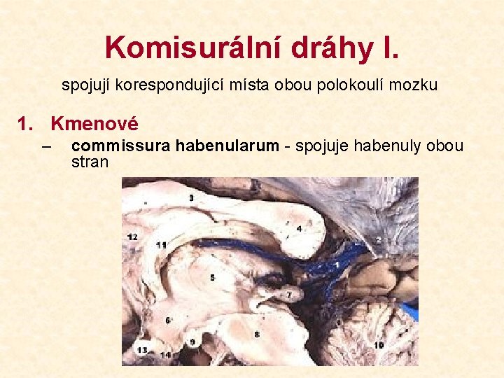 Komisurální dráhy I. spojují korespondující místa obou polokoulí mozku 1. Kmenové – commissura habenularum