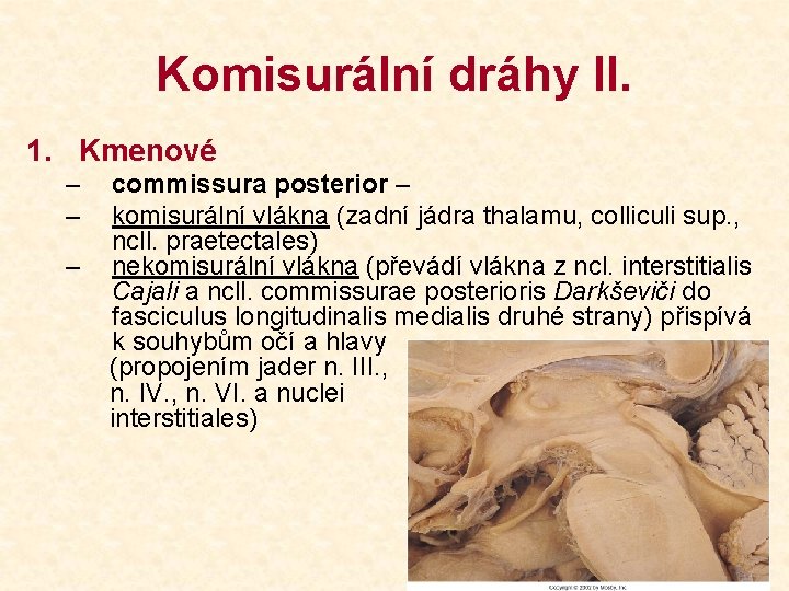 Komisurální dráhy II. 1. Kmenové – – – commissura posterior – komisurální vlákna (zadní