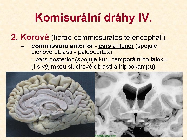 Komisurální dráhy IV. 2. Korové (fibrae commissurales telencephali) – commissura anterior - pars anterior