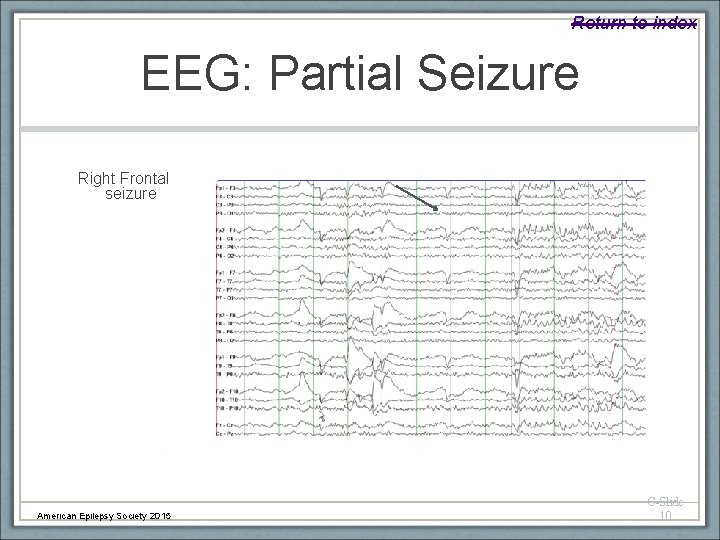 Return to index EEG: Partial Seizure Right Frontal seizure American Epilepsy Society 2015 C-Slide