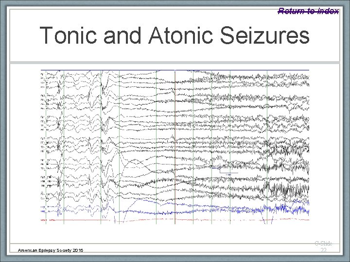 Return to index Tonic and Atonic Seizures American Epilepsy Society 2015 C-Slide 22 