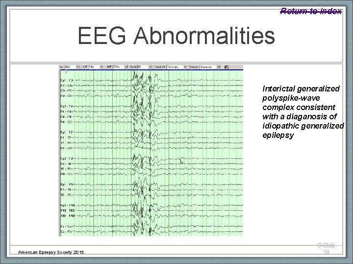 Return to index EEG Abnormalities Interictal generalized polyspike-wave complex consistent with a diaganosis of