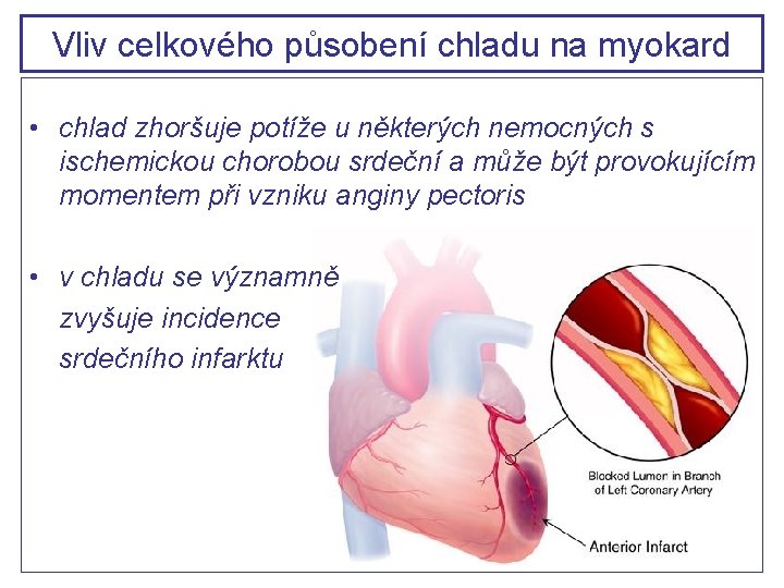 Vliv celkového působení chladu na myokard • chlad zhoršuje potíže u některých nemocných s