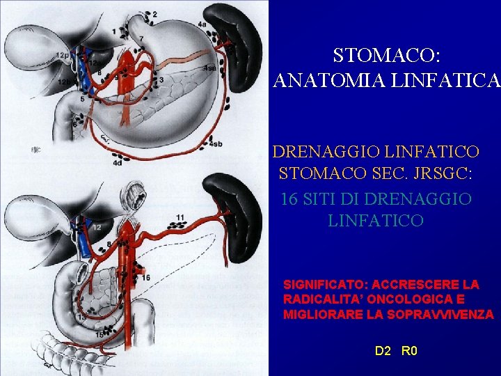 STOMACO: ANATOMIA LINFATICA DRENAGGIO LINFATICO STOMACO SEC. JRSGC: 16 SITI DI DRENAGGIO LINFATICO SIGNIFICATO: