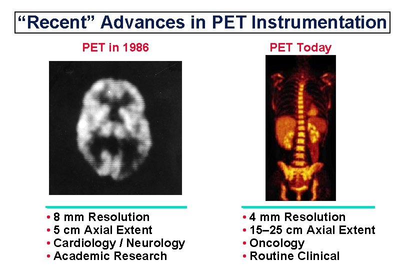 “Recent” Advances in PET Instrumentation PET in 1986 • 8 mm Resolution • 5