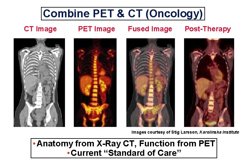 Combine PET & CT (Oncology) CT Image PET Image Fused Image Post-Therapy Images courtesy