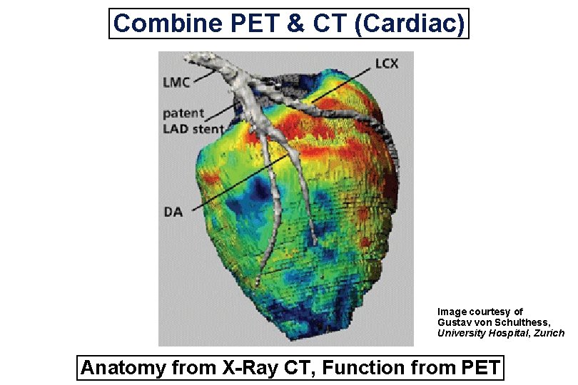 Combine PET & CT (Cardiac) Image courtesy of Gustav von Schulthess, University Hospital, Zurich
