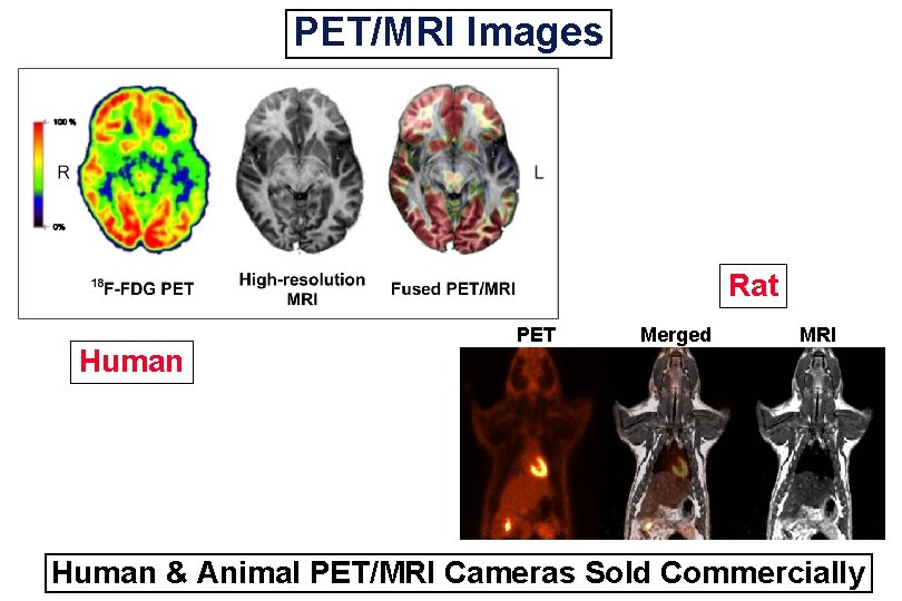 PET/MRI Images Rat Human PET Merged MRI Human & Animal PET/MRI Cameras Sold Commercially