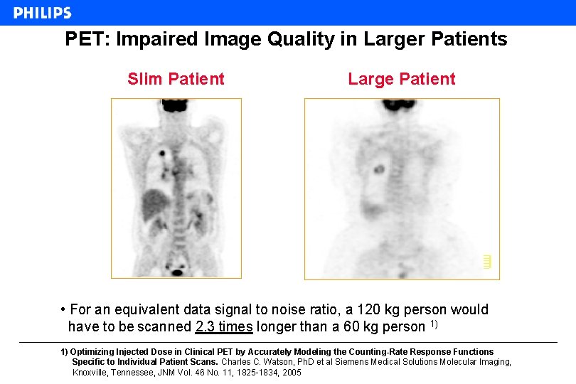 PET: Impaired Image Quality in Larger Patients Slim Patient Large Patient • For an